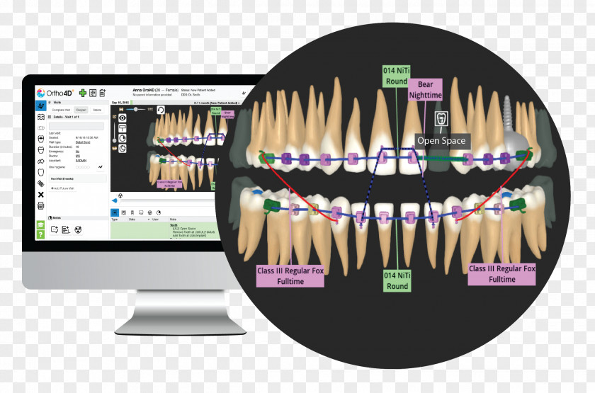 3d Dental Health Chart Orthodontics Human Tooth Clear Aligners Dentistry PNG