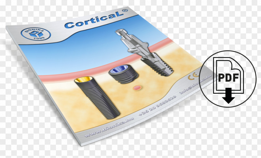 Chortyca Cortical Implant Bionics System PDF PNG