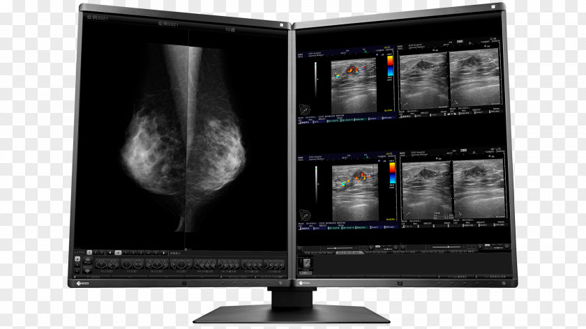 Computer Monitors Eizo Nanao EIZO RadiForce MX191 Liquid-crystal Display Electronic Visual PNG