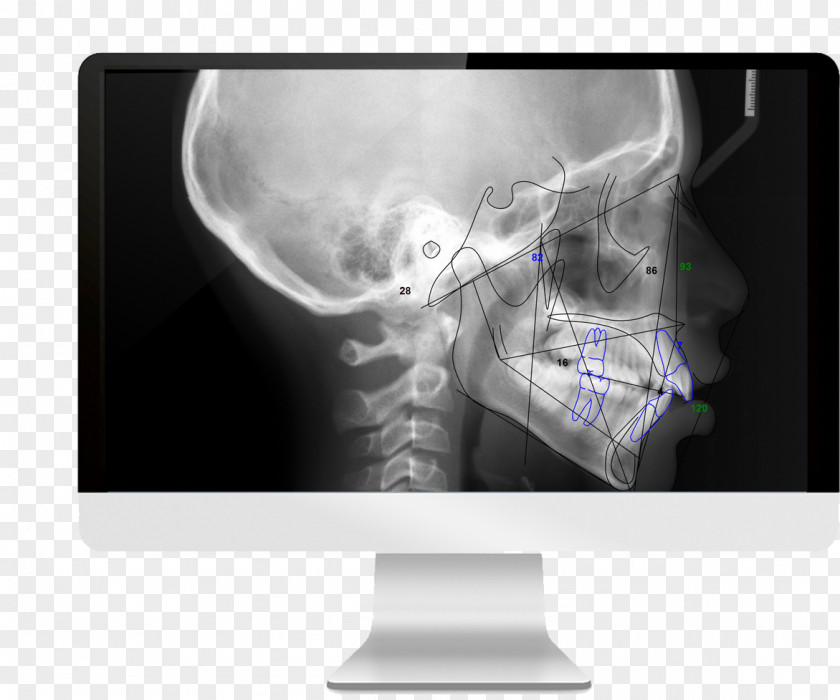 Medical Imaging Cone Beam Computed Tomography Radiography PNG