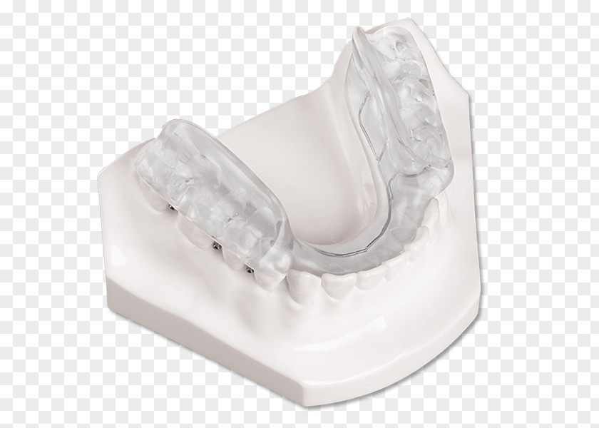 Splint Temporomandibular Joint Dysfunction Jaw Orthotics Twin Block Appliance PNG