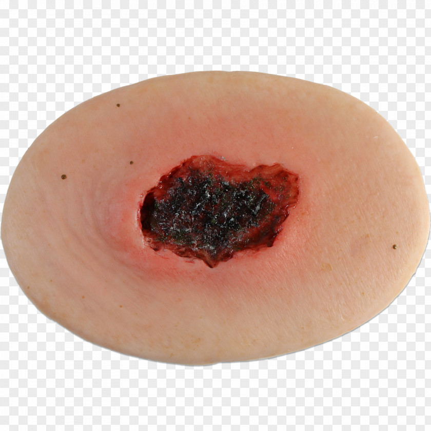 Wounds Mouth Lip PNG