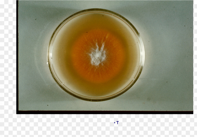 Microsporum Canis Subcutaneous Tissue Tinea Capitis Ringworm Exothrix PNG