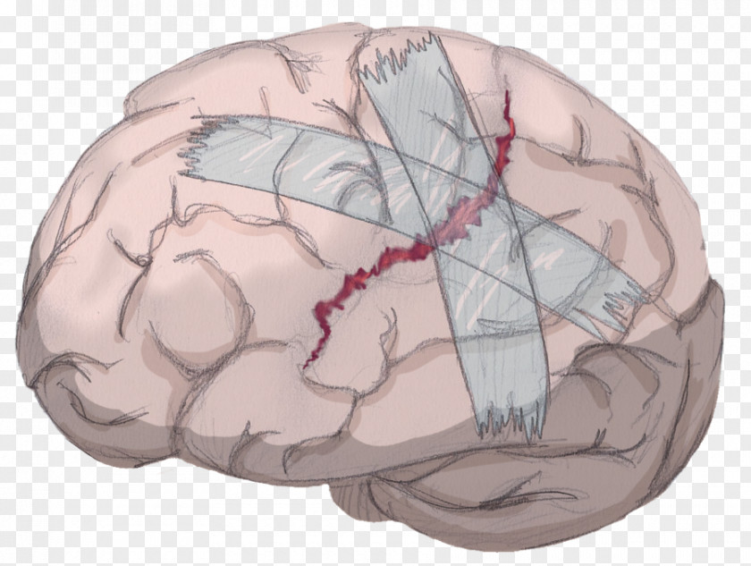Brain Neuroimaging TV Tropes Mind Head PNG