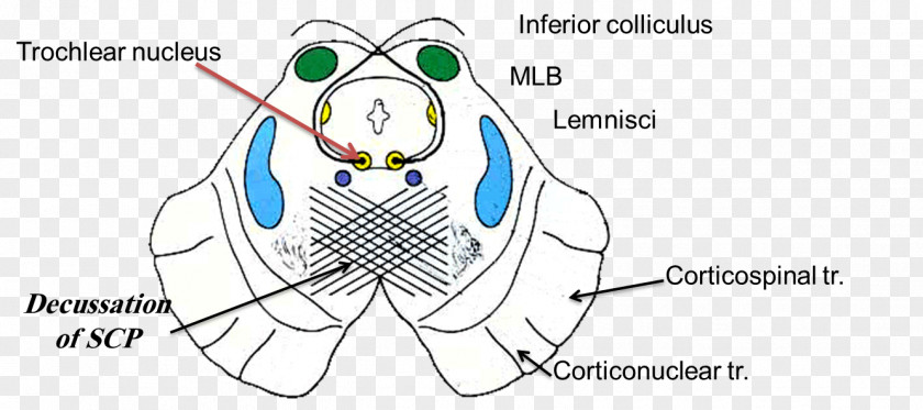 Brain Inferior Colliculus Trochlear Nerve Superior Midbrain Nucleus PNG