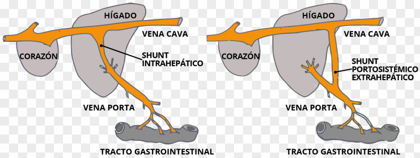 Anorexia Yorkshire Terrier Transjugular Intrahepatic Portosystemic Shunt Vein Liver PNG