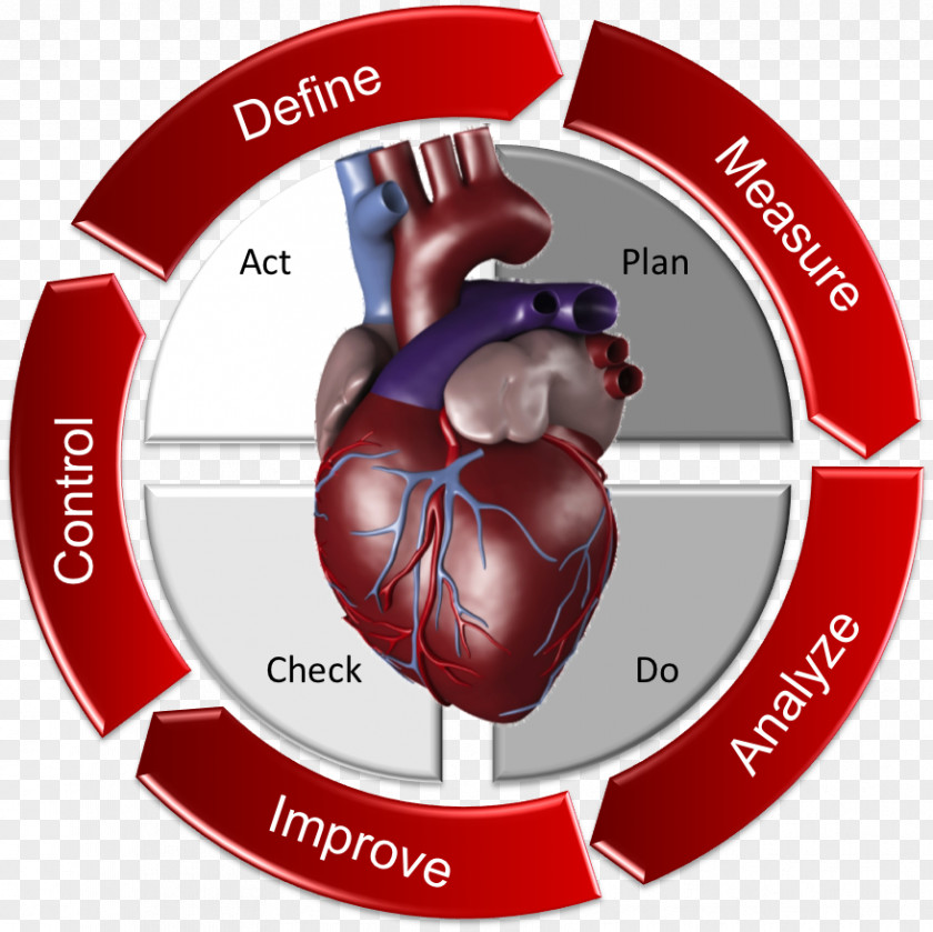 Heart Cardiac Surgery Sick Sinus Syndrome Bradycardia PNG