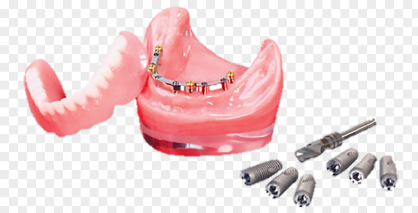 Utica Plastic Dental Laboratory PNG