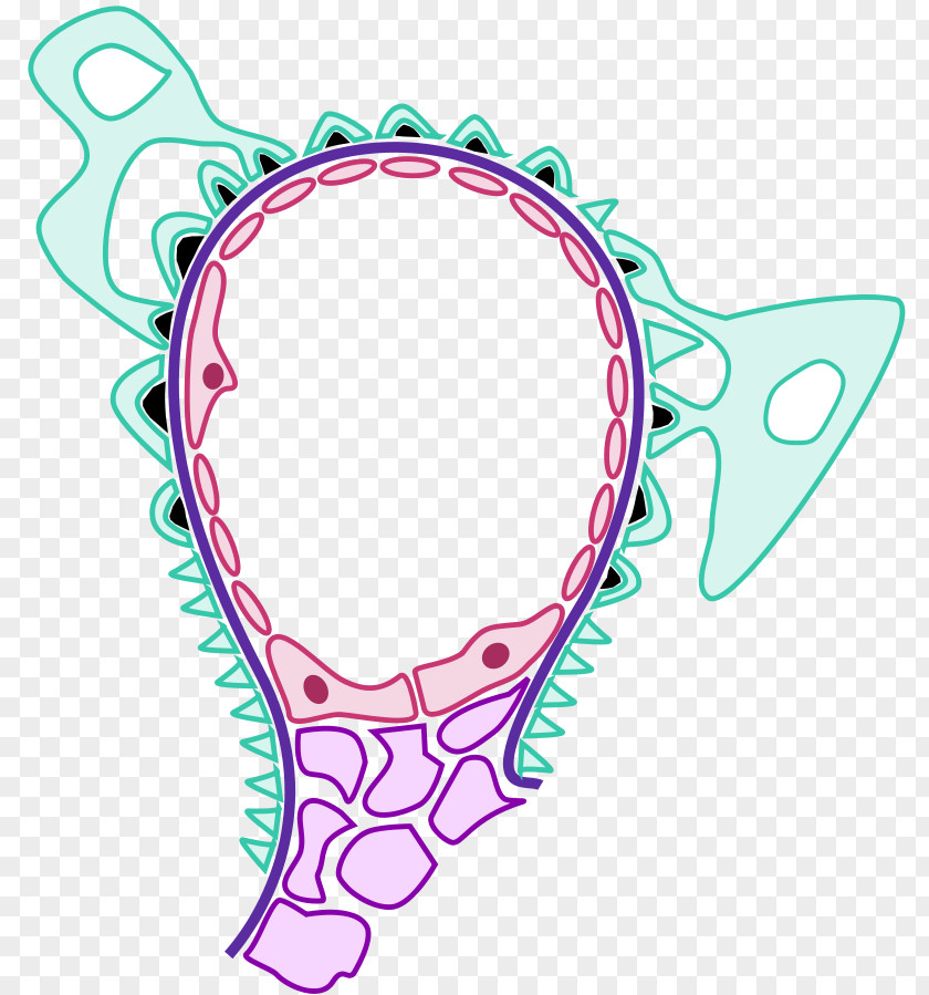 Acute Proliferative Glomerulonephritis IgA Nephropathy Kidney PNG