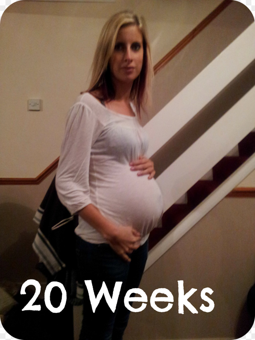 Pregnancy Week 20 Of Gestation Implantation Infant PNG