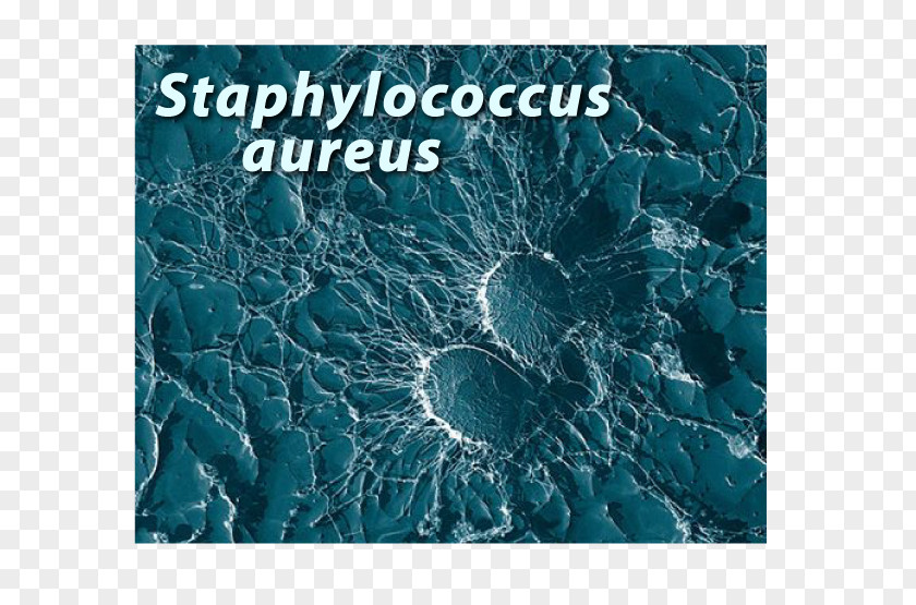 Bacteria Pointing Staphylococcus Aureus Infection Disease Strain PNG