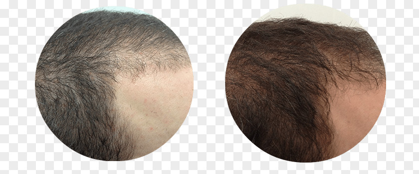 Ear Chin Brown Hair Brush Forehead PNG