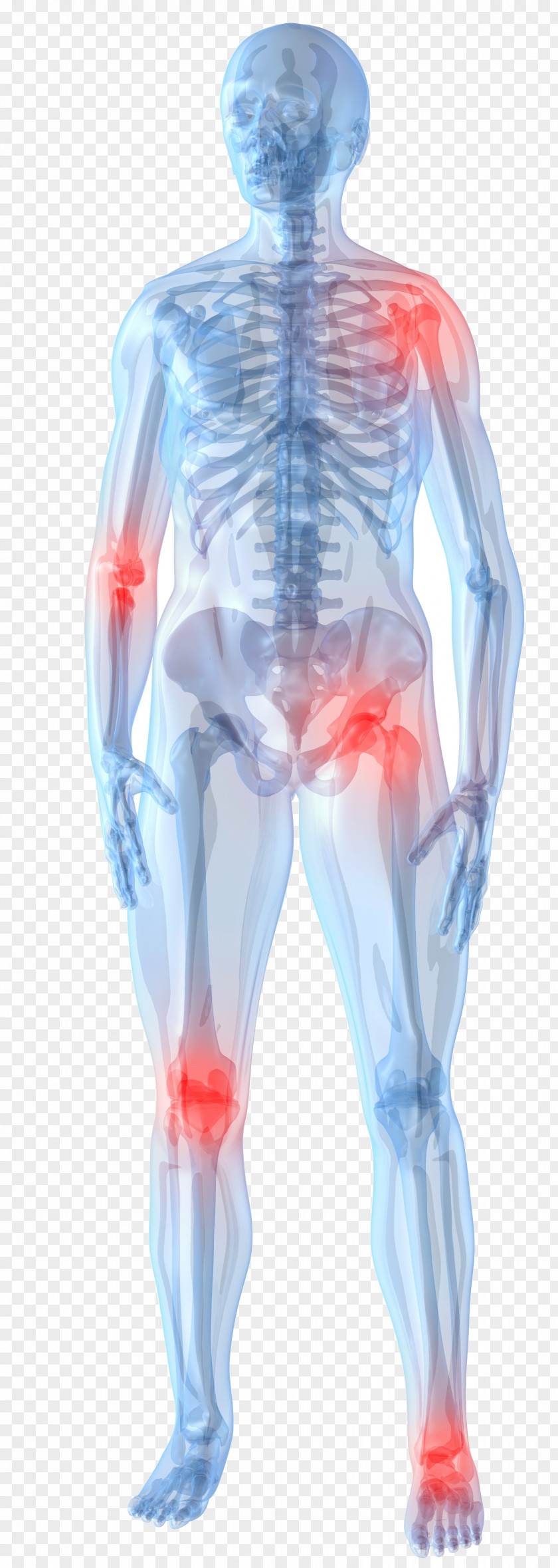 Joint Pain Knee Management Arthritis Therapy PNG