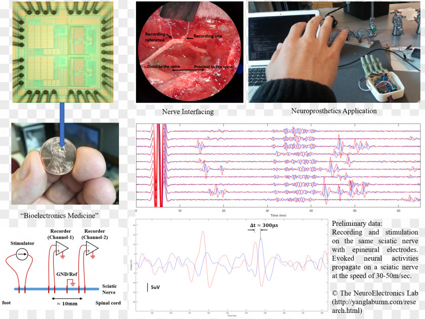 Biomedical Engineering Autonomic Nervous System Neurology Neurological Disorder University Of Minnesota PNG