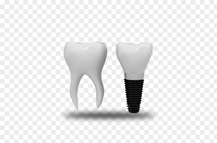 Tooth Dental Implant Dentistry Orthodontics PNG