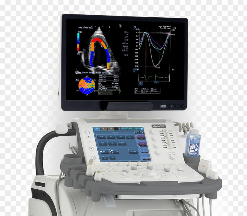 Uniqueness Quantification Ultrasonography Medical Equipment Imaging Medicine Cardiology PNG
