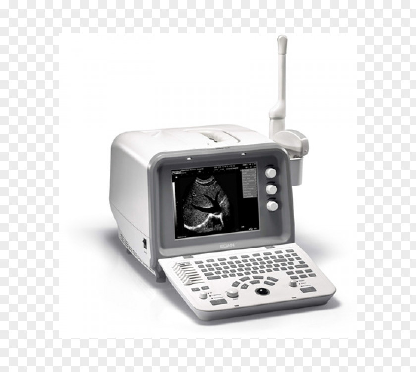 3D Ultrasound Ultrasonography Medical Equipment Voluson 730 PNG
