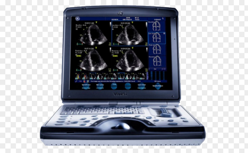 Ultrasonography SonoSite, Inc. GE Healthcare Cardiology Medical Equipment PNG