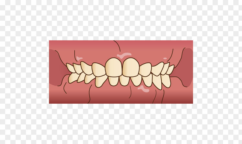 Kids Dental Tooth Dentist 歯科 Prognathism Hygienist PNG