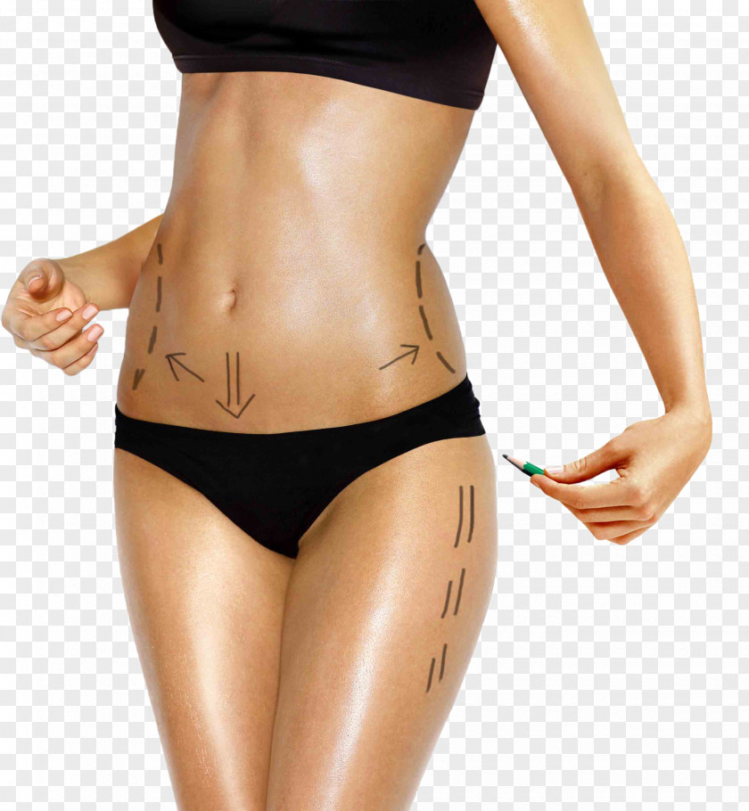 Slim Body Contouring Liposuction Human Belt Lipectomy Surgery PNG