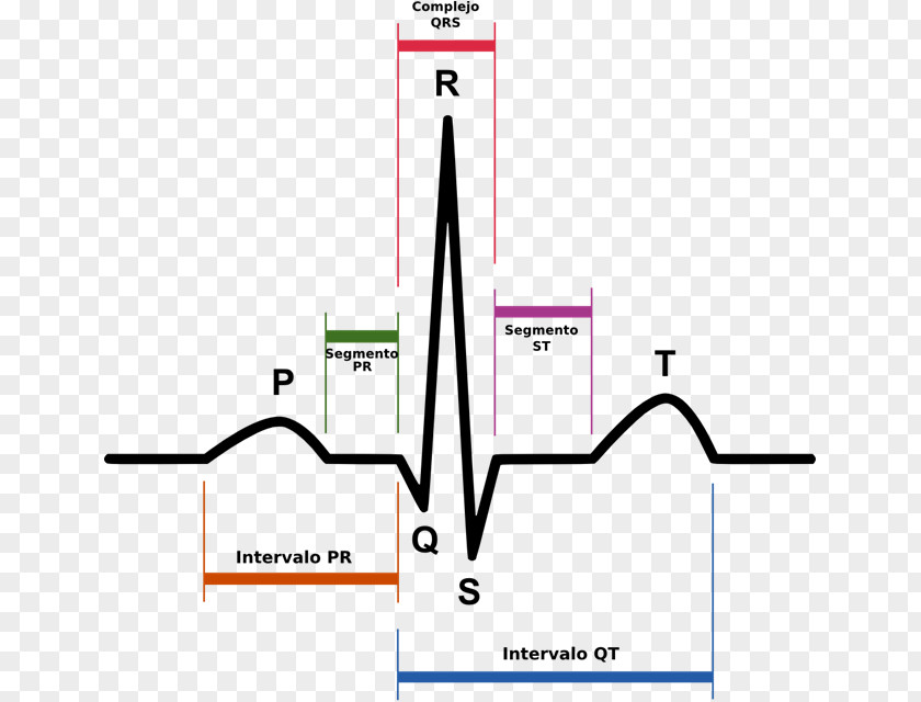 Wave Point Triangle Electrocardiography QRS Complex Sinus Rhythm Heart T PNG