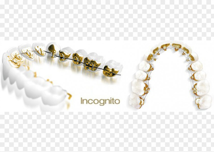 Incognito Lingual Braces Dental Orthodontics Clear Aligners Dentistry PNG