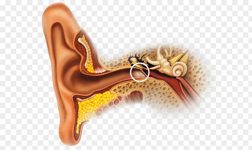 Ear Earwax Inner Canal Outer PNG