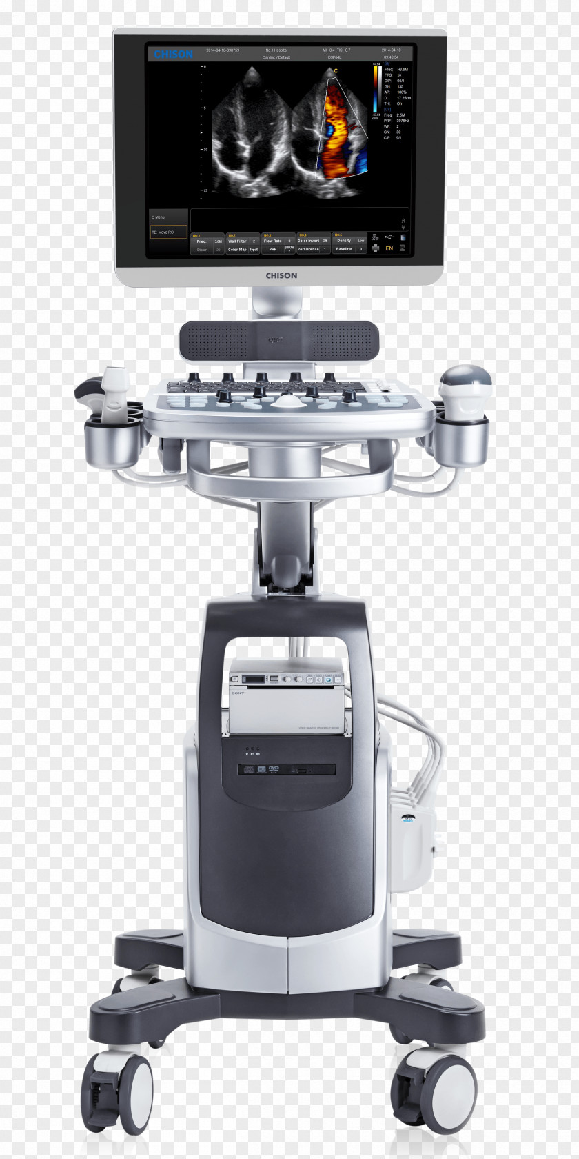 Ultrasound Machine Diagnostic Doppler Ultrasonography Portable PNG
