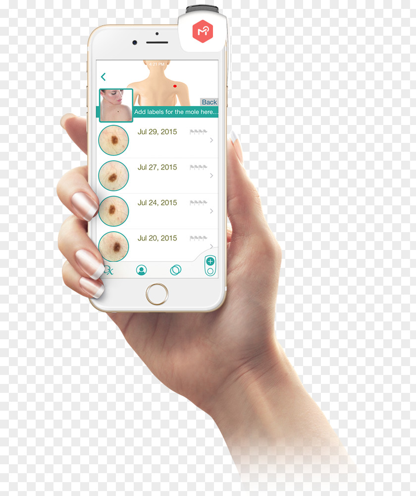 Skin Cancer Symptoms Mobile App User Android Smartphone PNG