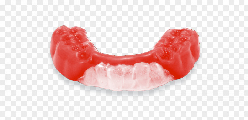 Mouthguard Tooth Athlete Sport Dentures PNG