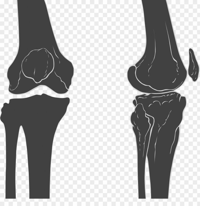 Joint Knee Femur Patella Bone PNG
