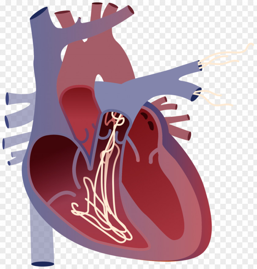 Dirofilariasis Heartworm Centro Veterinario VetSevilla Illustration PNG