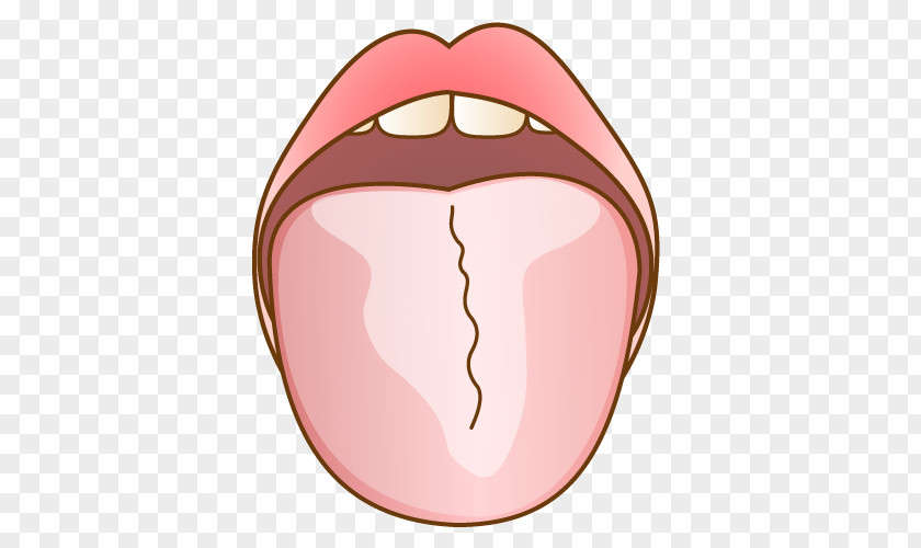 Tongue 舌苔 Dentist 歯科 Tooth PNG