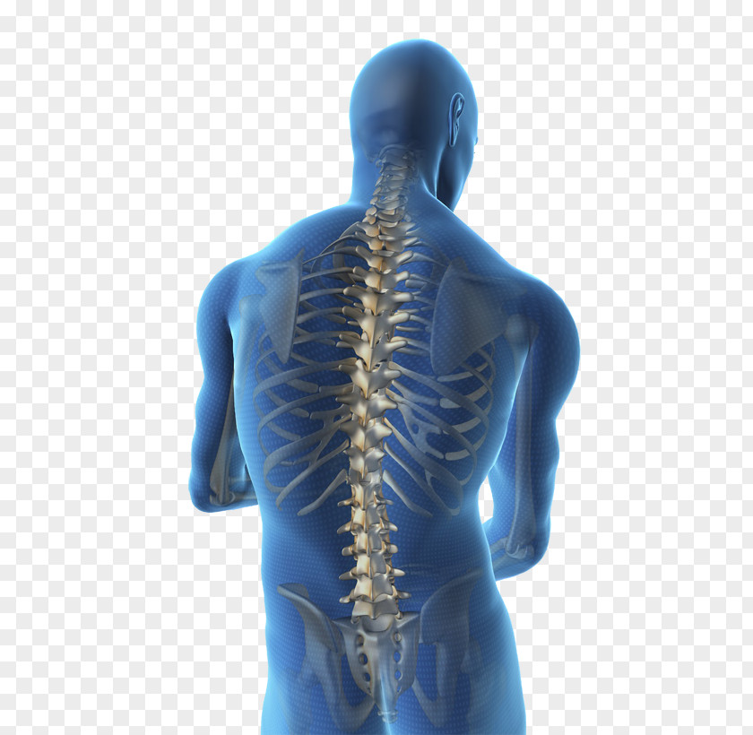 Vertebral Column Spinal Cord Human Back Body Stenosis PNG