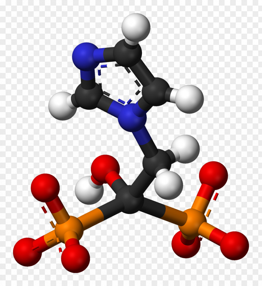 Alendronic Acid Osteoporosis Zoledronic Bisphosphonate Bone Density PNG