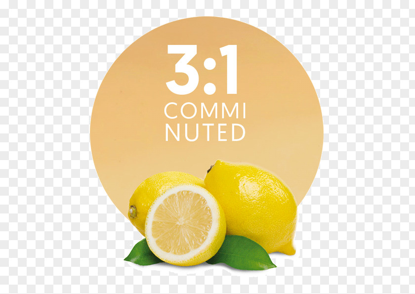 Lemon Lemon-lime Drink Juice Citron PNG