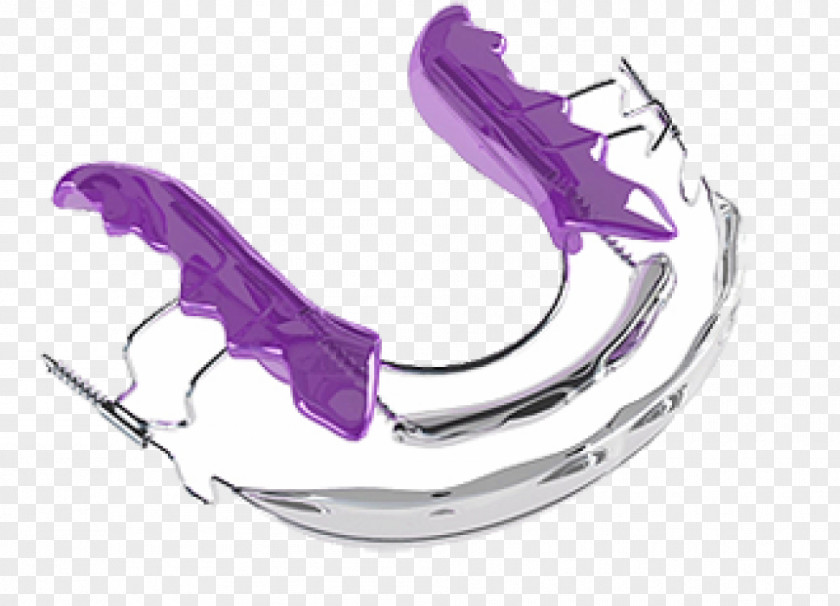 Clear Aligners Dental Braces Cosmetic Dentistry Orthodontics PNG