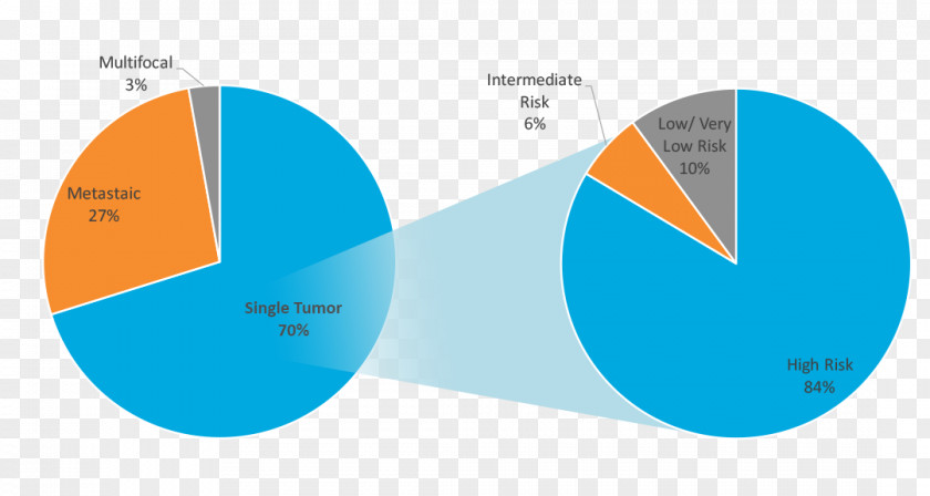 Gastrointestinal Stromal Tumor Chronic Myelogenous Leukemia Cancer Chart February PNG