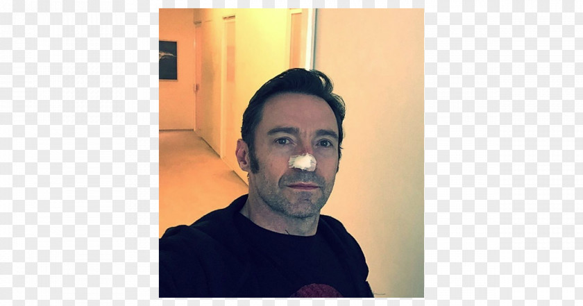 Hugh Jackman X-Men Wolverine Surgery Cancer PNG