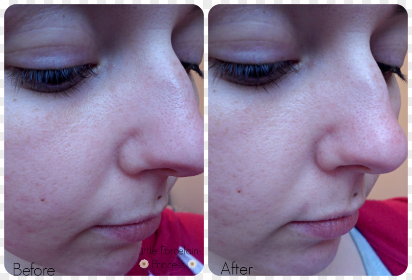 Nose Eyelash Extensions Comedo Facial Sebaceous Filament PNG