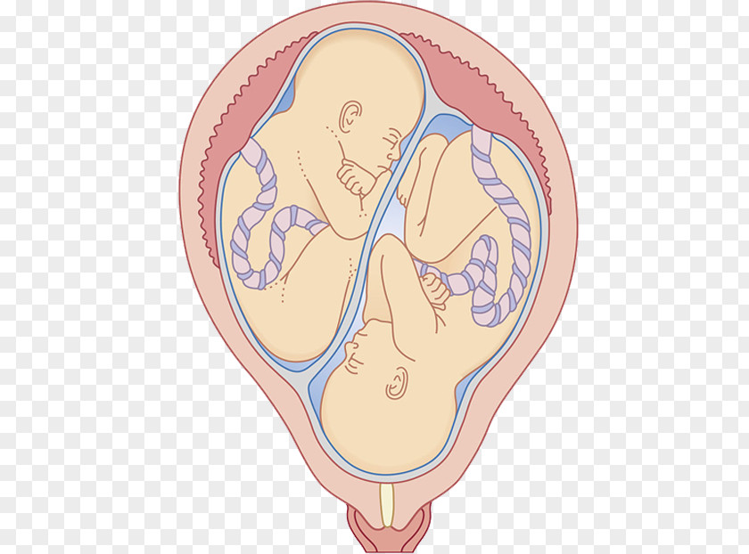 Twin Embryo Uterus Umbilical Cord Pregnancy Fertilisation PNG