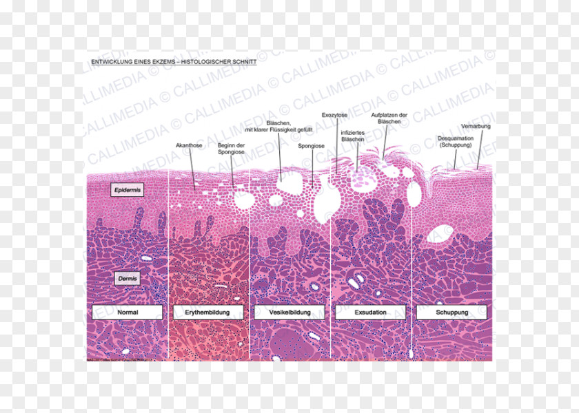 360 Degrees Histology Eczema Dermatitis Skin Corte Histológico PNG