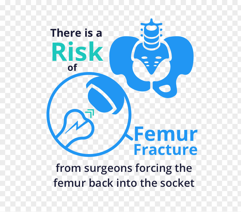 Hip Fracture Femur Femoral Head Bone PNG
