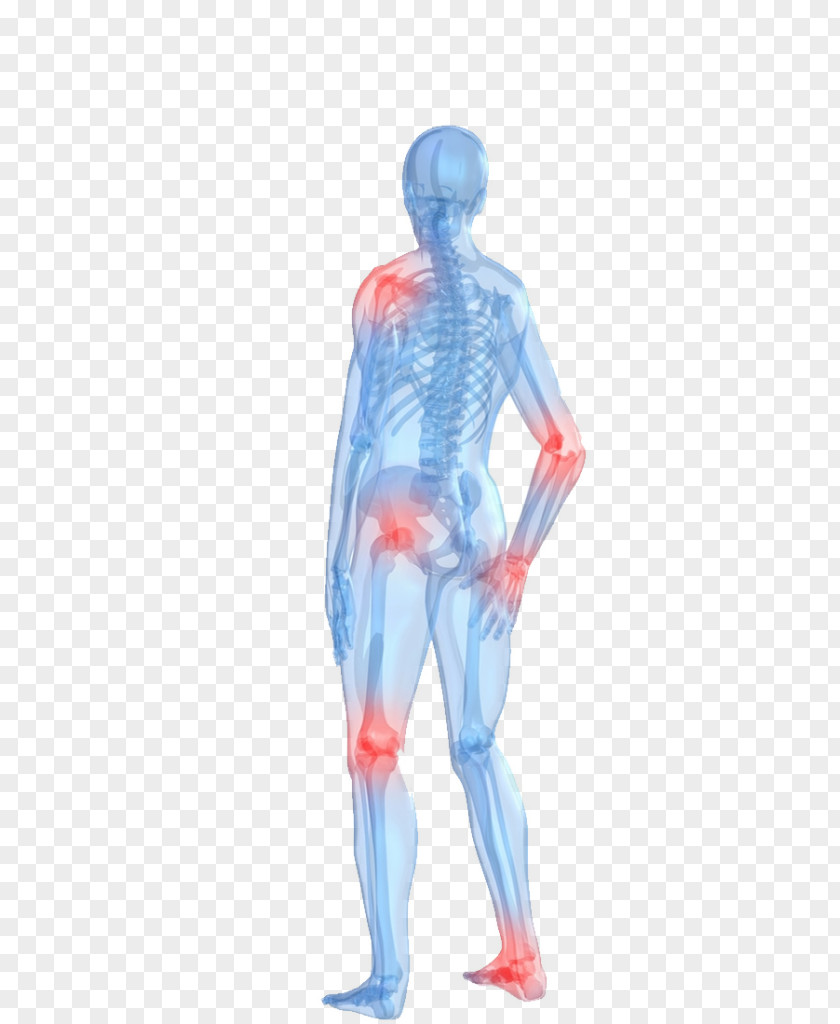 Body Pain Arthritis Human Rheumatoid Joint PNG