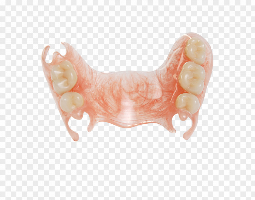 Dental Implant Deflex Tooth Empresa Virodent System PNG