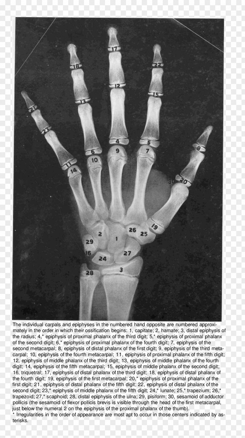 Hand Finger Bone Radiography Anatomy PNG