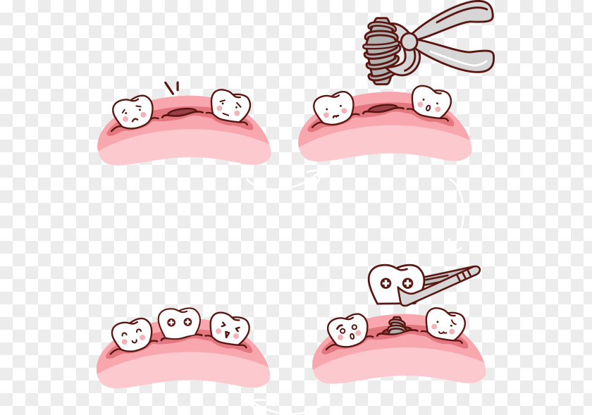 Dental Arch Drawing Tooth Implant PNG