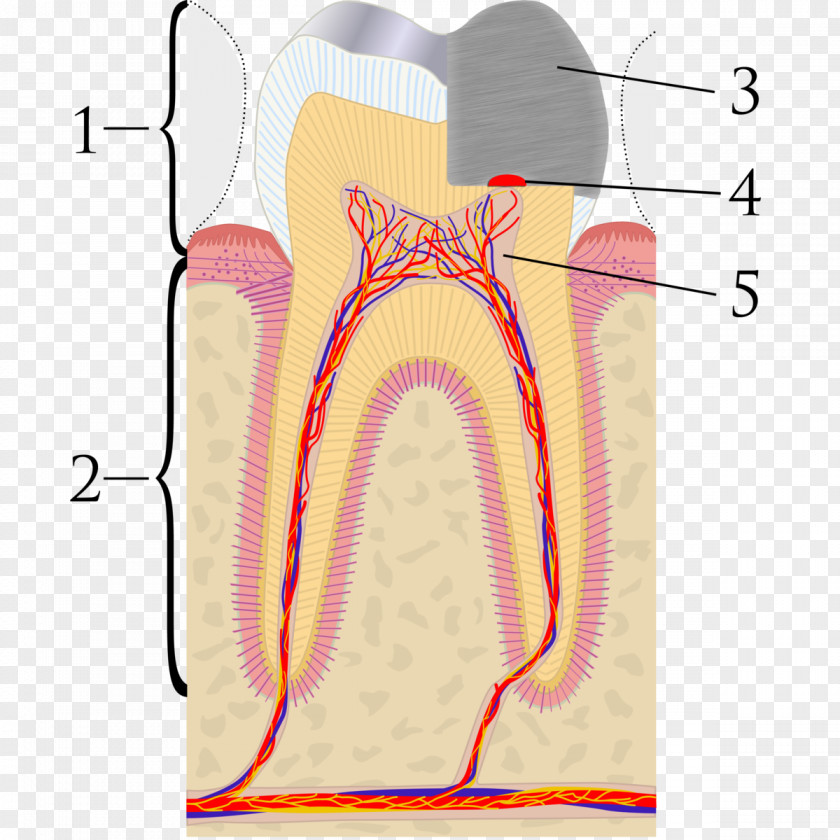 Pulp Capping Pulpitis Endodontic Therapy Dentist PNG