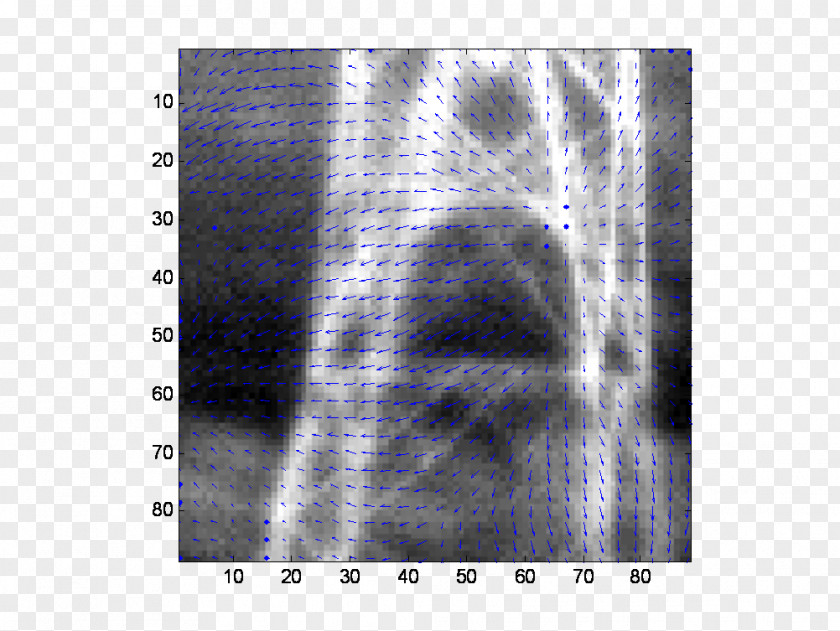 Passive Infrared Sensor X-ray Radiology Lääketieteellinen Röntgenkuvaus Radiography Angle PNG