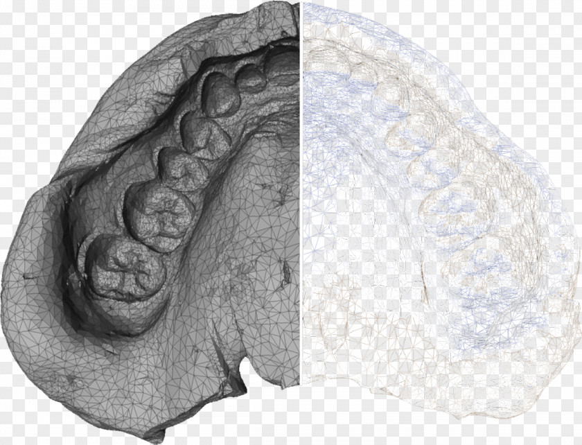 X-ray Dentistry Microtomography Computed Tomography Dentures PNG